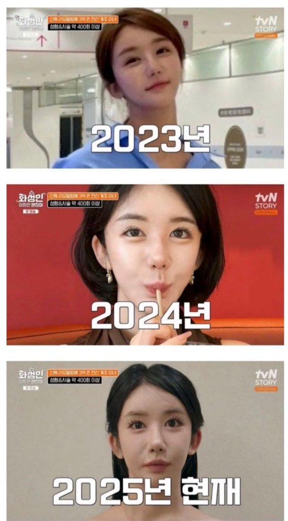 06e25f134522aabe5b036fc73520aa14_1780658862_151.jpg 성형 400번에 3억을 쓴 사람