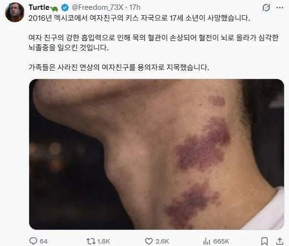 목에다 키스하면 안되는 이유 ㄷㄷㄷ