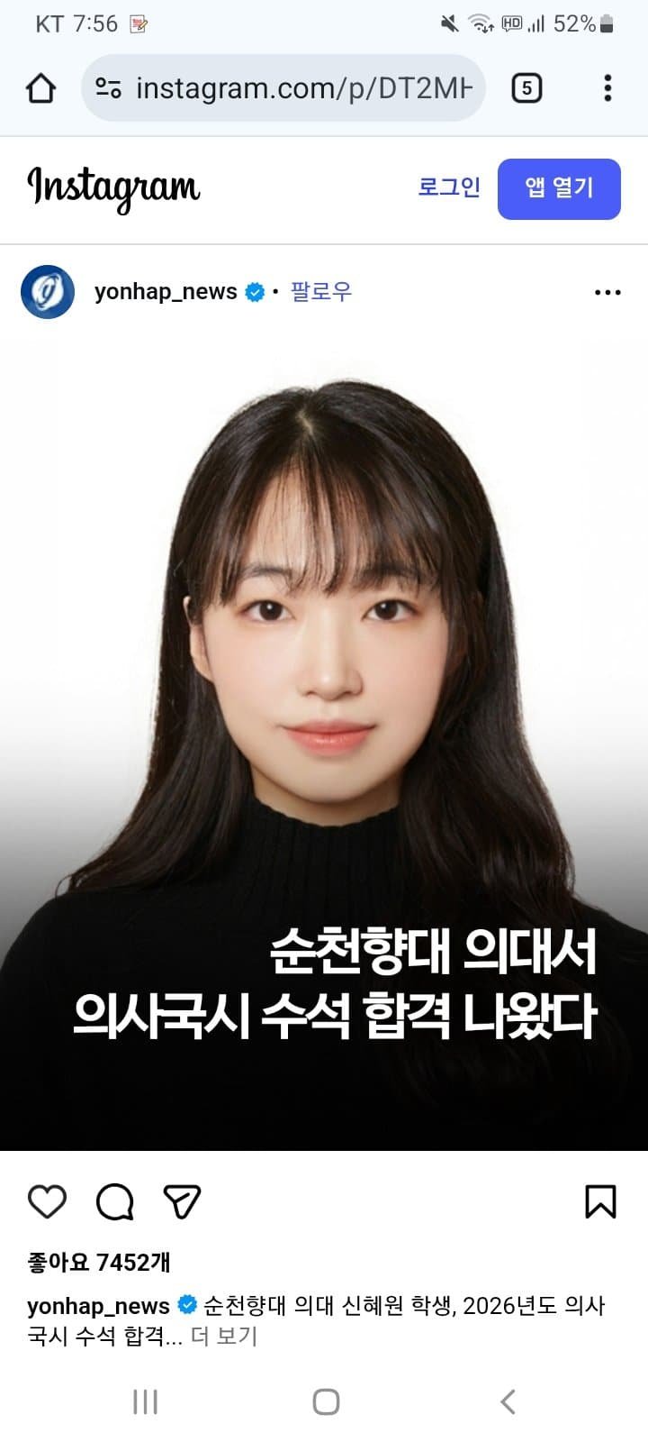 의사 국가시험 수석 합격 누나